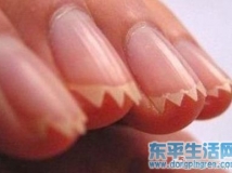 如果你女友把脚弄成这样，你会怎么办？